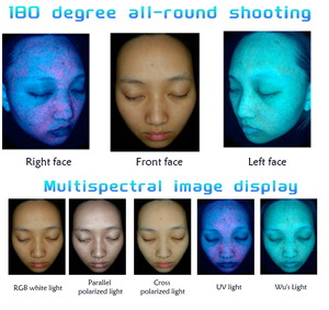 เครื่องวิเคราะห์ผิวหนัง AI 3 กล้อง พร้อมหน้าจอสัมผัส ใช้พลังงาน AI แบบพกพาสำหรับการวิเคราะห์สภาพผิว - Product Image 5