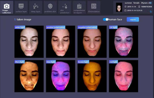 Tableta de dispositivo de espejo facial con escáner 3D profesional de 13,3 pulgadas e imágenes AI y HD para análisis profundo de la piel - Product Image 6