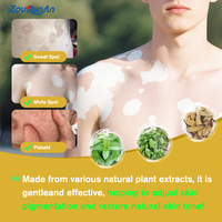 Crème de traitement au extrait d'herbes Zourunan pour le vitiligo, élimination de la teigne et des taches blanches, pommade contre le vitiligo