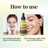 Sérum Visage Anti-Acné aux Herbes pour Peaux à Tendance Acnéique avec Extrait de Centella et Aloe Vera, Sérum Facial Apaisant et Séborégulateur
