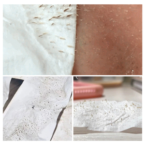 BREYLEE เซรั่มทีทรี แผ่นลอกสิวเสี้ยน มาส์กทำความสะอาดจมูก - Product Image 3