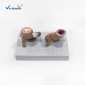 Modelo anatómico comparativo de pulmón de fumador; material didáctico para el control del tabaco; modelo educativo de salud para hospitales y - Product Image 3