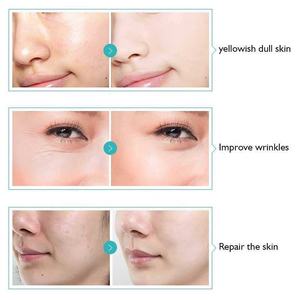Oem מגביר ייצור קולגן שתן תפוח תאי גזע חומצה היאלורונית סרום פנים - Product Image 5