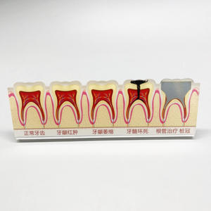 Model tampilan klinik gigi untuk menunjukkan penyakit periodalat-alat dan komunikasi antar gigi dalam renovasi mulut - Product Image 4