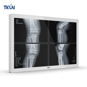 Новый 24-дюймовый медицинский промышленный плоский ЖК-монитор TKUN, 1000 нит, SDI, DVI, интерфейс 2MP, IPS, белый, HD, DP - Product Image 2