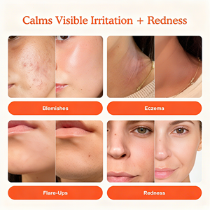 Spray Facial Vegano Orgánico Personalizado con Ácido Hipocloroso, Tónico Facial Calmante y Reparador HOCl para Enrojecimiento y Acné, OEM ODM Privado - Product Image 5