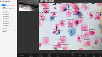 XINYU XYSSMA Cámara de Microscopio Personalizable con Software Remoto para Compartir Diapositivas, Investigación Científica, Conferencias en Línea, Enseñanza, 1 Año