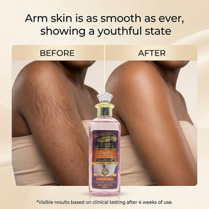 Minyak Tubuh Gluta Master Stretch Mark Formula Alami Bernutrisi Melembapkan Secara Mendalam Meningkatkan Elastisitas Memudarkan Bekas Kehamilan 200ml - Product Image 3