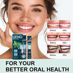 UENO - Enjuague Bucal en Barra Sin Alcohol, 12 ml * 20 Unidades, Tiras Desechables para Limpieza Bucal, Práctico Tamaño de Bolsillo - Product Image 5