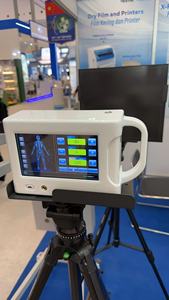 Machine à rayons X portable vétérinaire numérique 560W Système d'imagerie DR Machine à rayons X portable Équipement de radiologie DR - Product Image 5