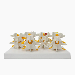 인간 척추 모델에서 정상 요추 및 4 단 요추 디스크 허리 병변 모델 - Product Image 2
