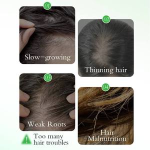 Aceite Orgánico de Romero para el Crecimiento del Cabello con Jojoba y Vitamina E, Nutritivo e Hidratante para Cabello Fino, Cuidado Natural del Cuero Cabelludo, Marca Privada - Product Image 5