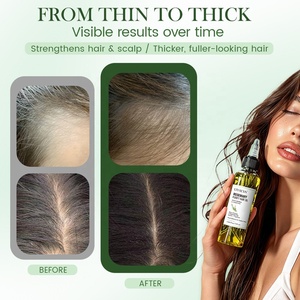 Custom Hair Care Strengthens Thicker Scalp Treatment Nourishing Biotin Natural Herbal Rosemary Hair Growth <strong>Oil</strong> - Product Image 6