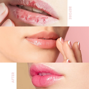 Mascarilla Labial Eelhoe de 4 Sabores: Fresa, Uva, Pomelo y Melocotón, OEM, Hidratante, Exfoliante y Nutritiva, Bálsamo Labial - Product Image 4