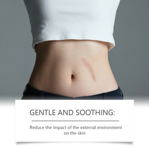 ครีมบำรุงผิวกายวิตามินอี 15 กรัม คุณภาพสูง ยอดขายดี พกพาสะดวก สำหรับลดรอยแตกลายและบำรุงผิวให้เรียบเนียน - Product Image 2