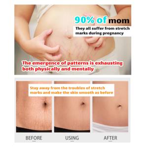 ROUSHUN <span class=keywords><strong>Huile</strong></span> <span class=keywords><strong>essentielle</strong></span> corporelle Yaourt d'<span class=keywords><strong>escargot</strong></span> <span class=keywords><strong>Huile</strong></span> éclaircissante anti-acné pour le visage et le corps - Product Image 2