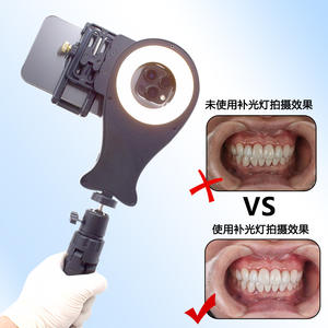 Luz LED Dental de Relleno, Anillo de Luz Bicolor 3200k 5600k Recargable de Plástico para Fotografía Oral - Product Image 2