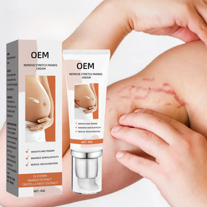 Crème Réparatrice <span class=keywords><strong>Bio</strong></span> Naturelle OEM ODM Contre les Vergetures – La Meilleure Crème <span class=keywords><strong>Anti</strong></span>-Vergetures pour Soins de Santé - Product Image 6