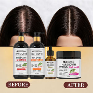 Ensemble Shampooing et Après-Shampooing Capillaire à l'Huile de Batana, Kératine Végétale, pour Cheveux Bouclés Longs, Brillance, Repousse et Anti-Chute, Marque Privée - Product Image 2