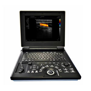 Equipamento médico ultra-som portátil Full Digital Color <span class=keywords><strong>Doppler</strong></span> <span class=keywords><strong>Ultrasonic</strong></span> Diagnostic System - Product Image 1