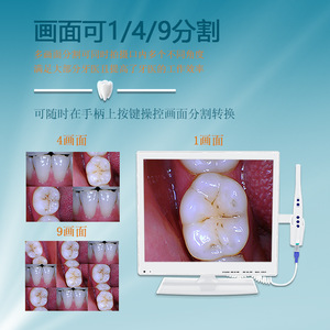 Endoscopio Dental con Wifi, Toma de Fotos, Monitor de Alta Definición de 17 Pulgadas, Escáner Intraoral Médico - Product Image 4