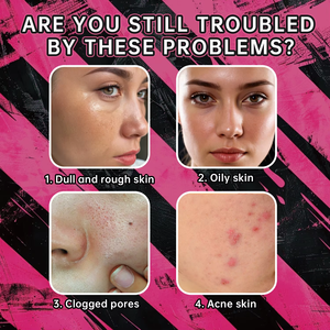 Nouveau Savon <span class=keywords><strong>Visage</strong></span> Nettoyant en Profondeur Éclaircissant Anti-Taches et Resserre les Pores à la Nicotinamide et à l'Acide Kojique, Savon à la Niacinamide - Product Image 6