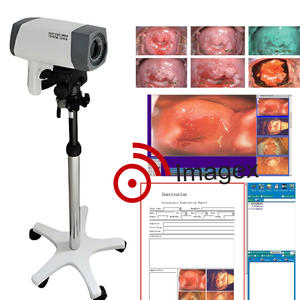 <span class=keywords><strong>Vaginoscope</strong></span> électronique numérique Colposcope vidéo pour examen gynécologique - Product Image 2