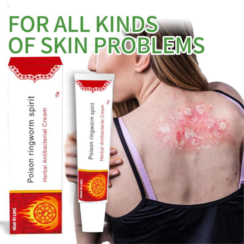 Herbal Skin-soothing Ingredient Ointment for Psoriasis, Acne, Dermatitis, Scrotal Eczema, Pityriasis