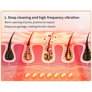 Chuyên nghiệp xách tay không dây sạc siêu âm Skin Scrubber điện Sonic Facial Exfoliator thiết bị cho mũi đầu làm sạch - Product Image 6