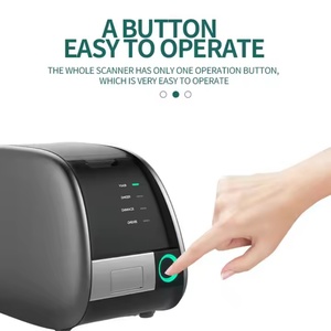 Escáner Portátil Digital de Placas de Fósforo Dental de Alta Resolución para Clínicas/Hospitales - Modelos Explosivos de Ventas - Product Image 2