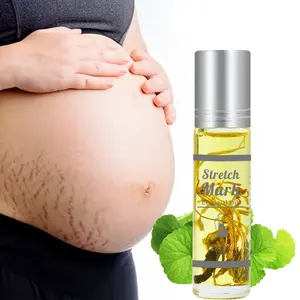 Chinaphers minyak tanda kerutan tubuh penghilang bekas luka hamil efektif memperbaiki tanaman minyak zaitun Vitamin E Tanda kehamilan bekas luka tubuh