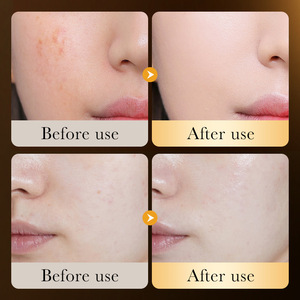OEM ZOZU <span class=keywords><strong>meilleures</strong></span> ventes or acide hyaluronique organique hydratant réparation vitamine c soins de beauté ensemble série - Product Image 4