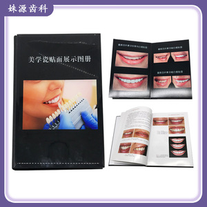 Materiales Dentales: Blanqueamiento Dental, Carillas de Porcelana, Catálogo de Carillas de Porcelana Total, Álbum de Fotos de Cristal, Exhibidor - Product Image 5