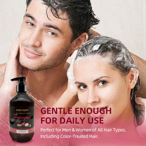 Dưỡng ẩm tự nhiên màu đỏ hành tây dầu gội đầu cho sự tăng trưởng tóc tăng cường và ngăn ngừa vỡ chăm sóc tóc - Product Image 3