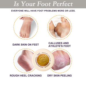 TWG <span class=keywords><strong>crema</strong></span> <span class=keywords><strong>per</strong></span> <span class=keywords><strong>piedi</strong></span> <span class=keywords><strong>per</strong></span> tacchi secchi screpolati <span class=keywords><strong>crema</strong></span> <span class=keywords><strong>per</strong></span> la cura del piede <span class=keywords><strong>crema</strong></span> <span class=keywords><strong>per</strong></span> le mani Anti Cracking <span class=keywords><strong>piedi</strong></span> - Product Image 3