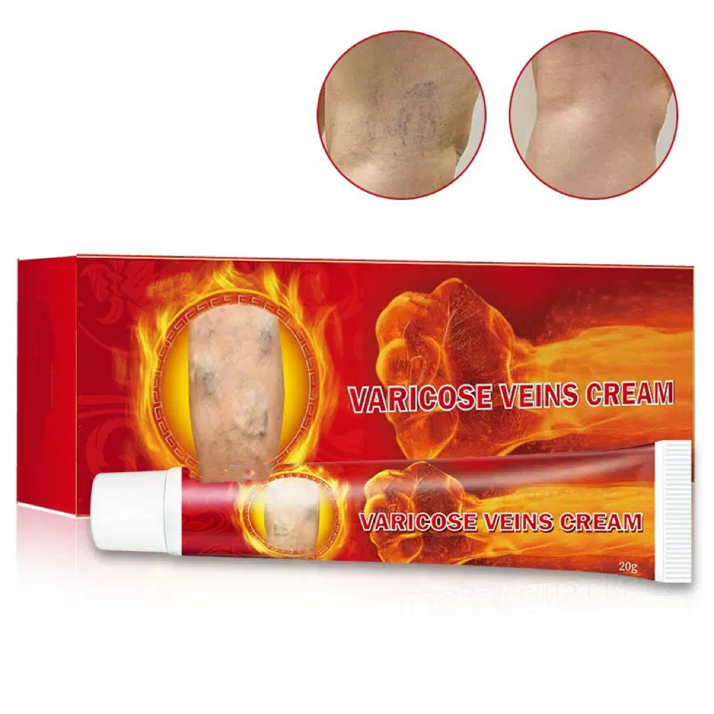 Intravenous Health Care Ointment for Leg Swelling Earthworm Skin External Cream Varicose Vein Massage Cream Body Care Product