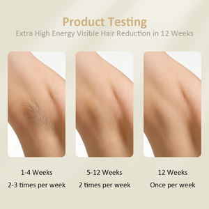 Dispositivo de <span class=keywords><strong>Depilación</strong></span> Láser IPL con Lámpara de Cuarzo y Enfriamiento con Hielo, Indoloro, para Cuerpo, Bikini, Rostro, Piernas, <span class=keywords><strong>Espalda</strong></span>, Labios, Brazos y Axilas, con Gafas Protectoras - Product Image 4