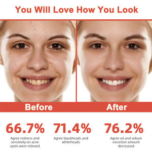 תווית פרטית אנטי-אייג 'ינג אנטי-קמט סרום פנים ויטמין c רשתית תיקון שמן מוצרי טיפוח העור הטבעי - Product Image 6