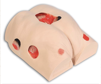 Modèle d'ulcère du coccyx en plastique, simulation de plusieurs types de plaies pour la formation en soins médicaux, éducation aux ulcères de pression et soins infirmiers