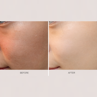 Ampoule éclaircissante et blanchissante à la niacinamide anti-âge et anti-rides White Recipe 50ml