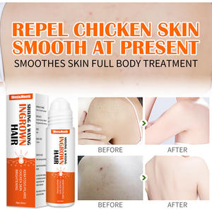 Logo personnalisé Mois de l'Ouest Prévenir les poils incarnés sérum rasoir bouchon contre les bosses peau lisse tendre Solution pour les poils incarnés - Product Image 3