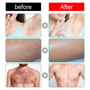 Crème dépilatoire indolore à base de plantes pour hommes et femmes Crème dépilatoire permanente 5 minutes d'efficacité - Product Image 4