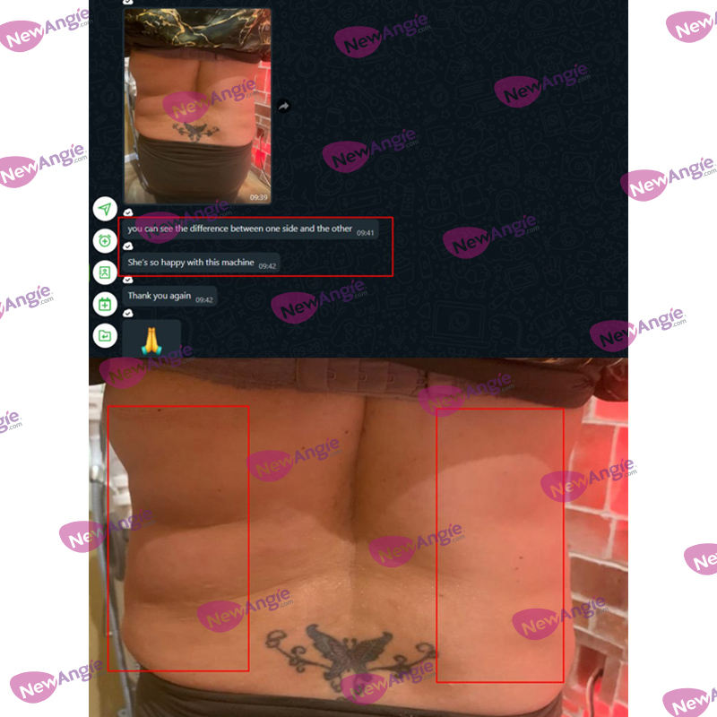 ORANGLES Newangie HIFU 12D Professional Beauty Machine | 4-in-1 Body Slimming & Vaginal Tightening System | Facial & Body Lifting Device – orangles Qatar - elegant presentation - exhibiting components - Image 6 of 6 | ideal for home | Discount on Newangie HIFU 12D Professional Beauty Machine | 4-in-1 Body Slimming & Vaginal Tightening System | Facial & Body Lifting Device – orangles Qatar Virginia | Free Shipping ORANGLES