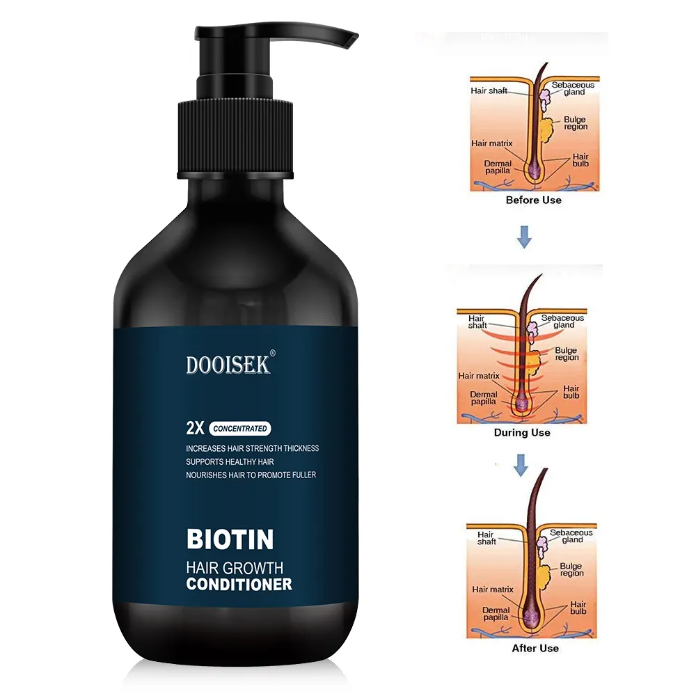 Private Label Bio Biotin Haarwuchs Shampoo und Conditioner Set Kräuter verdickung Anti Haarausfall Shampoo