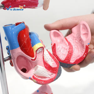 Modelo Anatómico Médico de Patología, Modelo Educativo de Hipertensión, Modelo de Enseñanza de Presión Arterial Alta, Anatomía del Cuerpo Humano - Product Image 5