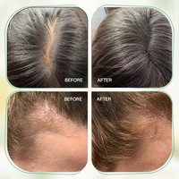 Sérum Réparateur Naturel et Biologique au Romarin Contre la Chute des Cheveux, Traitement Stimulant la Croissance Capillaire, Huile Essentielle pour Cheveux
