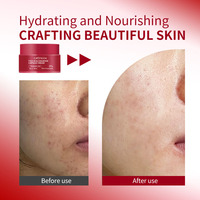 Greenlem CAPSULECREAM TXA NIACINAMIDE Formule en capsules granulaires pour éclaircir le teint et soigner les peaux sujettes à l'acné