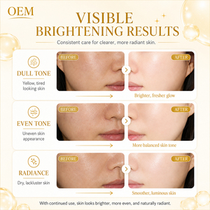 Traitement Concentré Éclaircissant Effet Peau de Verre Anti-Rides Soin Booster Vitamine C en Seringue Sérum Facial à la Niacinamide - Product Image 3