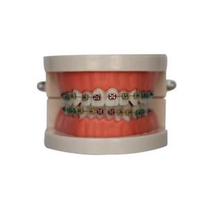 Divertenti bretelle finte fili in acciaio inossidabile staffe colorate protezione per le labbra elegante denti Cosplay - Product Image 4