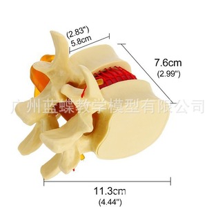 Modèle de démonstration de compression des disques intervertébraux lombaires humains, modèle d'agrandissement de la colonne vertébrale lombaire, colonne vertébrale pathologique - Product Image 4